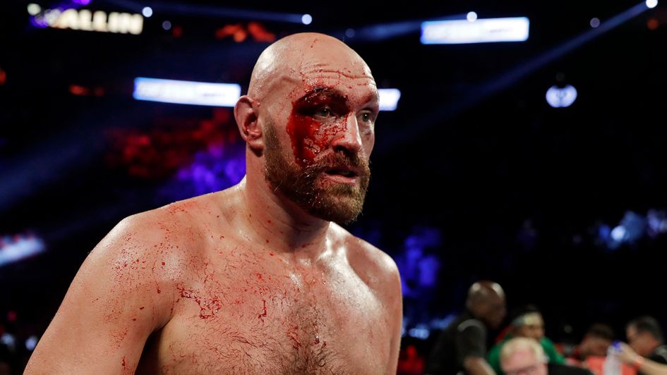 Tyson Fury